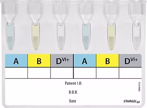 STARGEL10 Group Check (Donor)