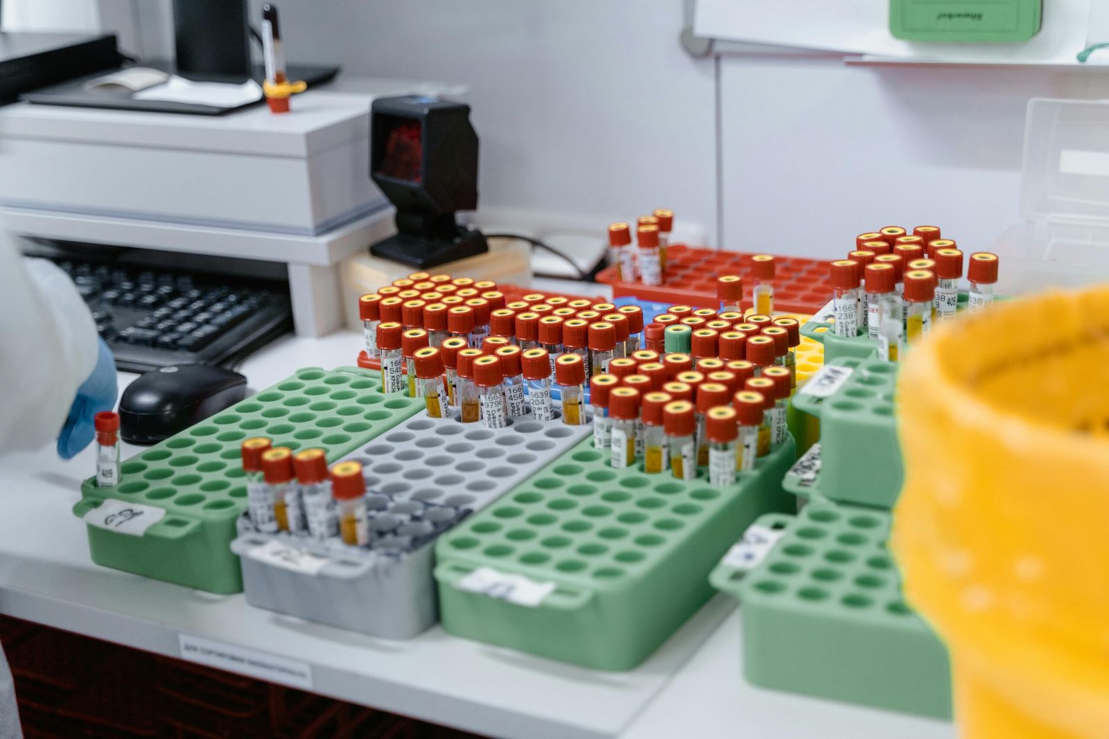 Blood sample tubes in a laboratory rack